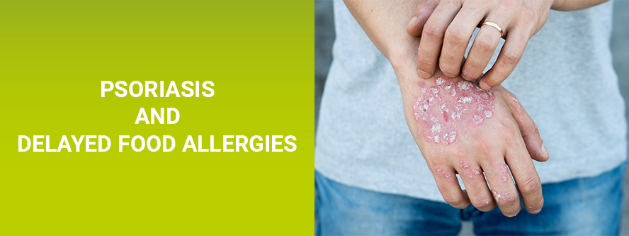 Psoriasis and delayed food allergy